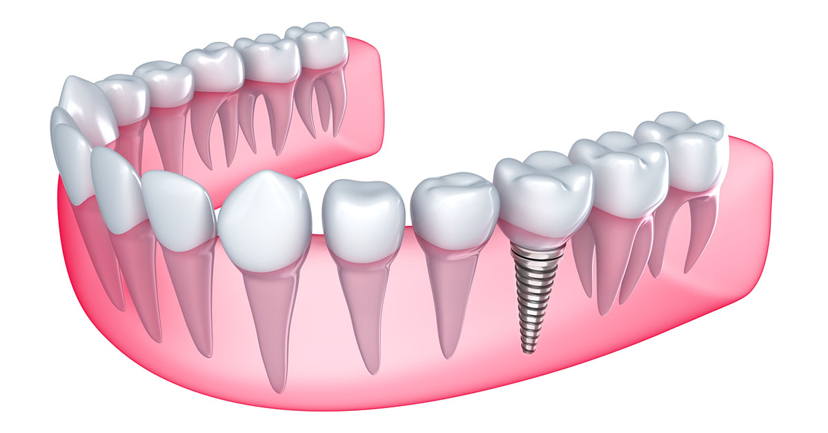 دراسة ماجستير طب الأسنان في مصر للوافدين